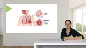 Prophylaxen in der Pflege